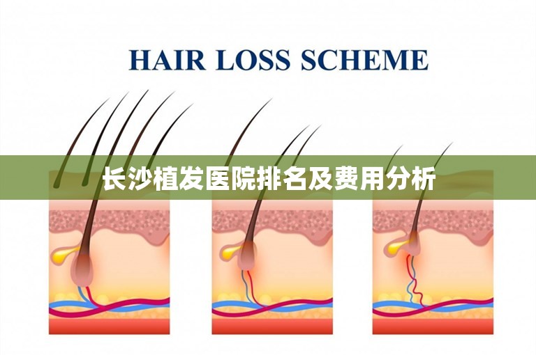 长沙植发医院排名及费用分析