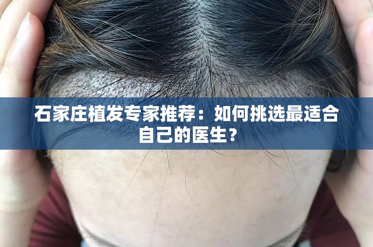 石家庄植发专家推荐：如何挑选最适合自己的医生？