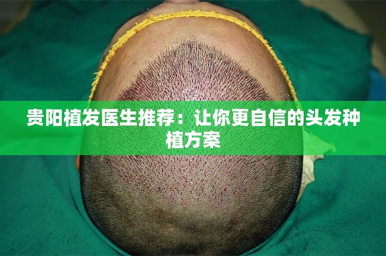 贵阳植发医生推荐：让你更自信的头发种植方案