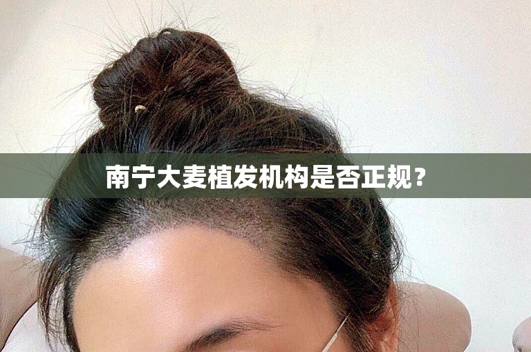 南宁大麦植发机构是否正规？