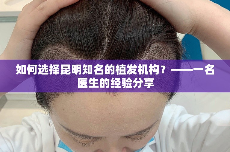 如何选择昆明知名的植发机构？——一名医生的经验分享