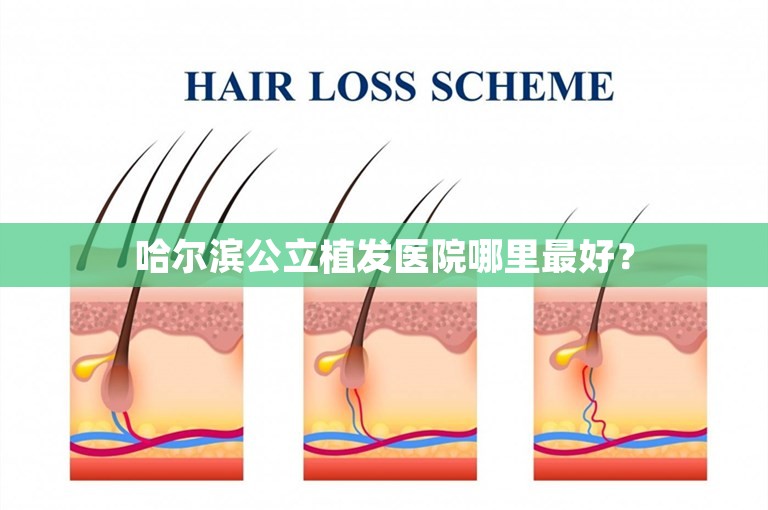 哈尔滨公立植发医院哪里最好？