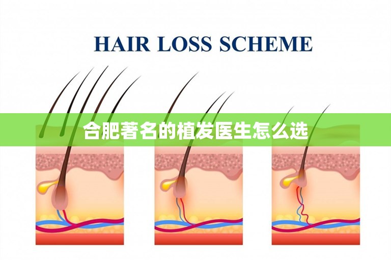 合肥著名的植发医生怎么选