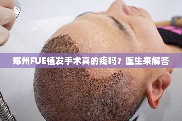 郑州FUE植发手术真的疼吗？医生来解答