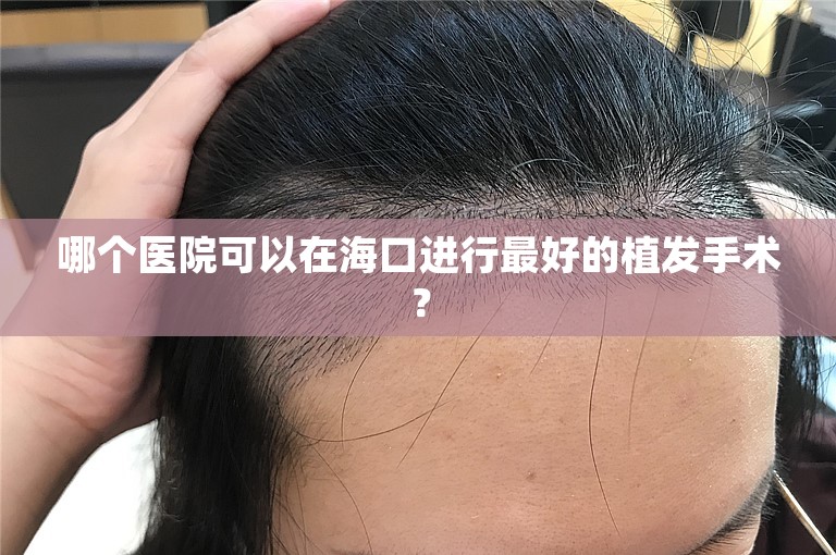 哪个医院可以在海口进行最好的植发手术？