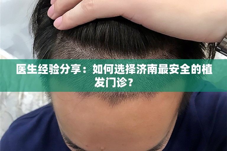 医生经验分享：如何选择济南最安全的植发门诊？