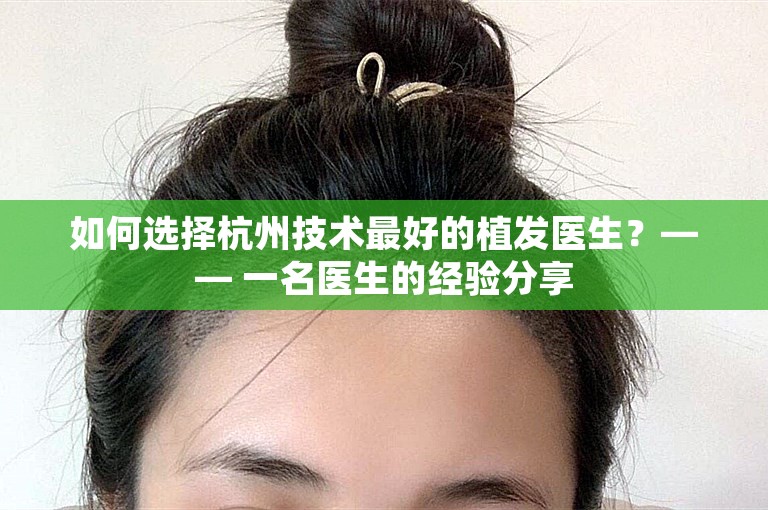 如何选择杭州技术最好的植发医生？—— 一名医生的经验分享