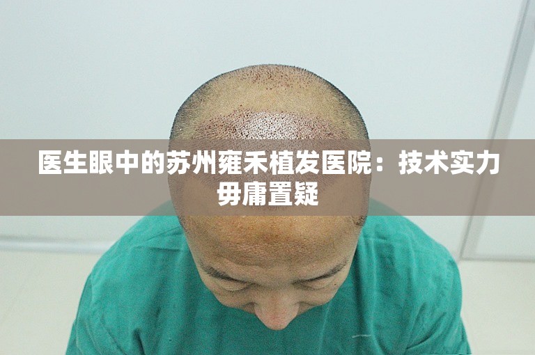 医生眼中的苏州雍禾植发医院：技术实力毋庸置疑