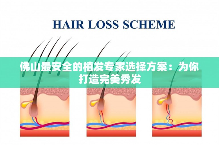 佛山最安全的植发专家选择方案：为你打造完美秀发