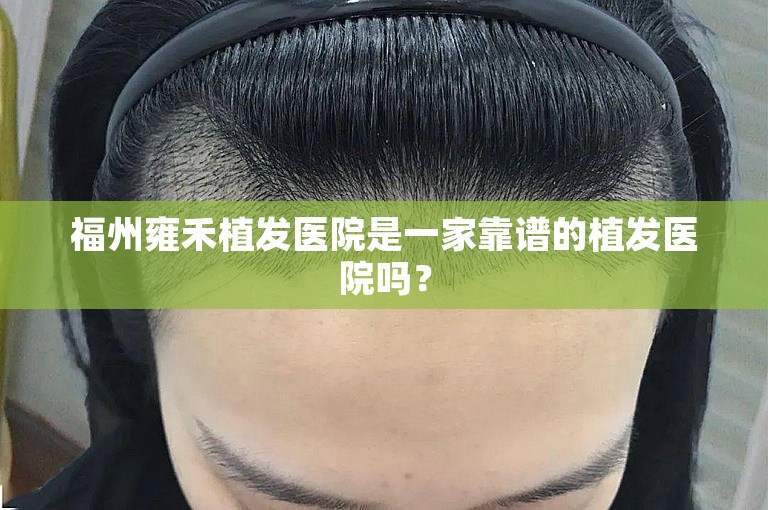 福州雍禾植发医院是一家靠谱的植发医院吗？