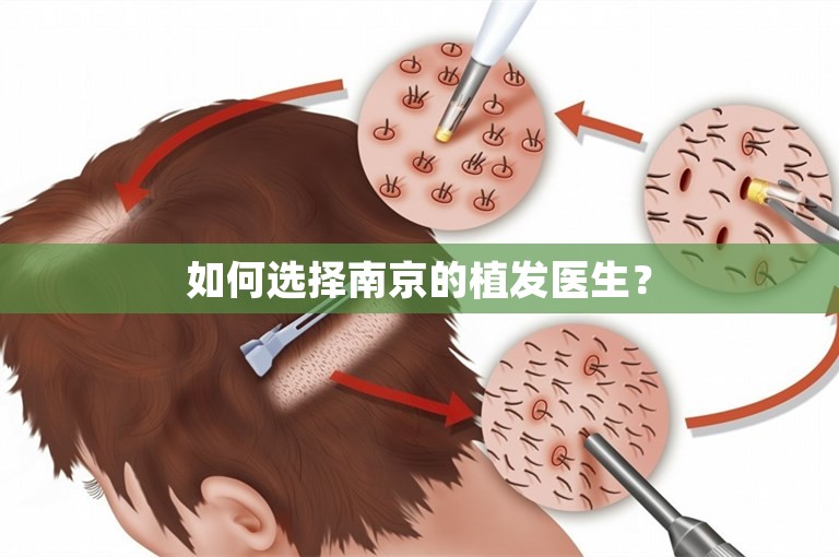 如何选择南京的植发医生？