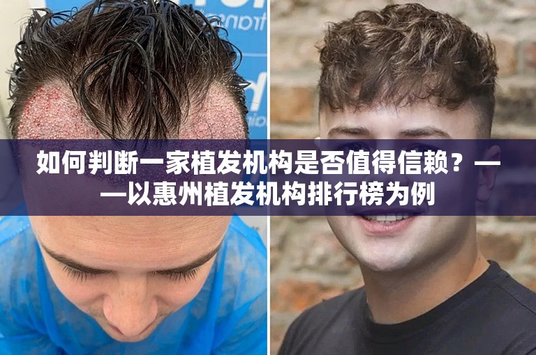 如何判断一家植发机构是否值得信赖？——以惠州植发机构排行榜为例