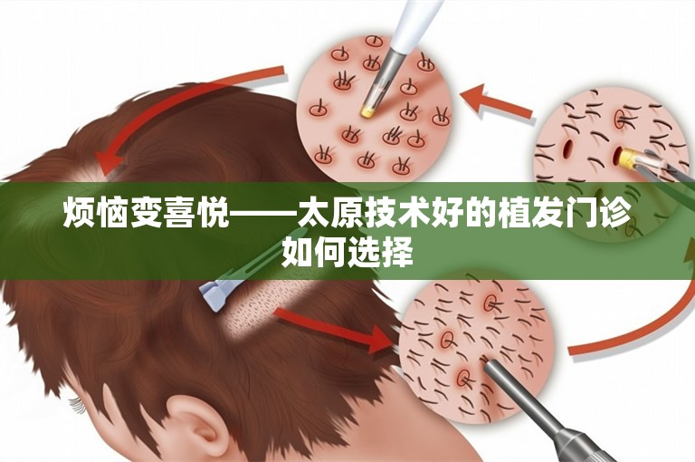 烦恼变喜悦——太原技术好的植发门诊如何选择