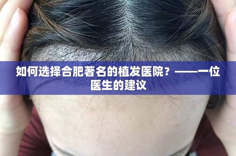 如何选择合肥著名的植发医院？——一位医生的建议