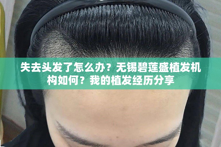 失去头发了怎么办？无锡碧莲盛植发机构如何？我的植发经历分享