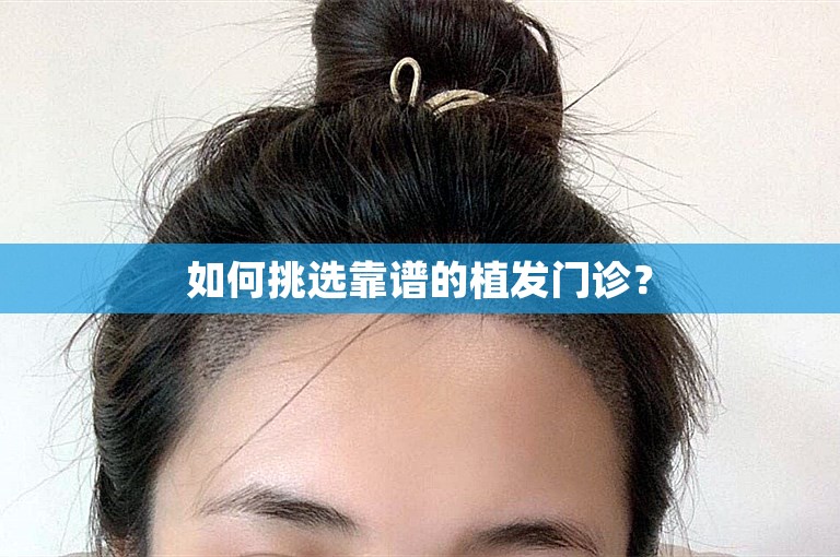 如何挑选靠谱的植发门诊？