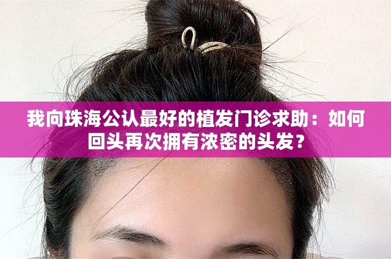 我向珠海公认最好的植发门诊求助：如何回头再次拥有浓密的头发？