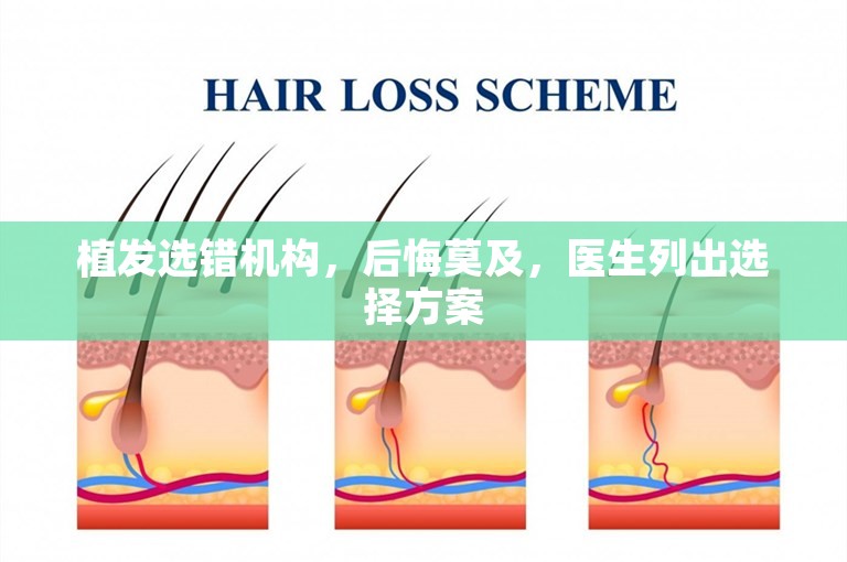 植发选错机构，后悔莫及，医生列出选择方案