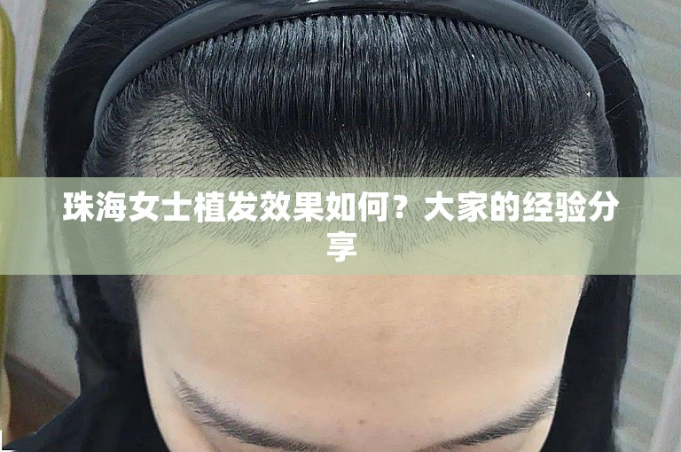 珠海女士植发效果如何？大家的经验分享