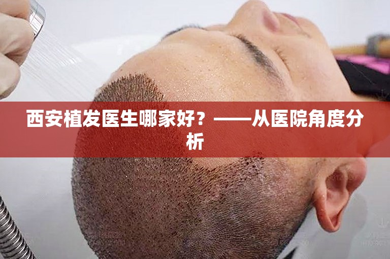 西安植发医生哪家好？——从医院角度分析