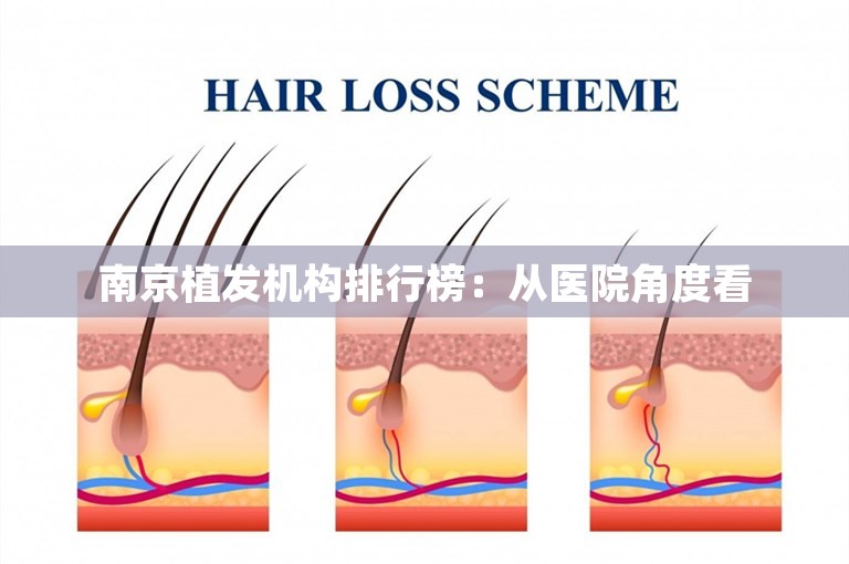 南京植发机构排行榜：从医院角度看