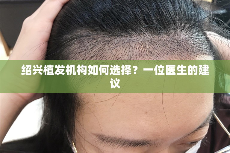 绍兴植发机构如何选择？一位医生的建议