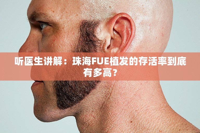 听医生讲解：珠海FUE植发的存活率到底有多高？