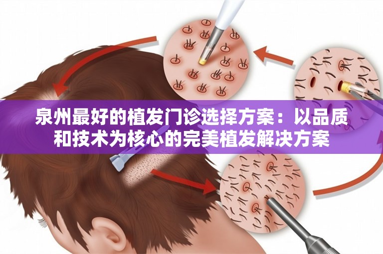 泉州最好的植发门诊选择方案：以品质和技术为核心的完美植发解决方案