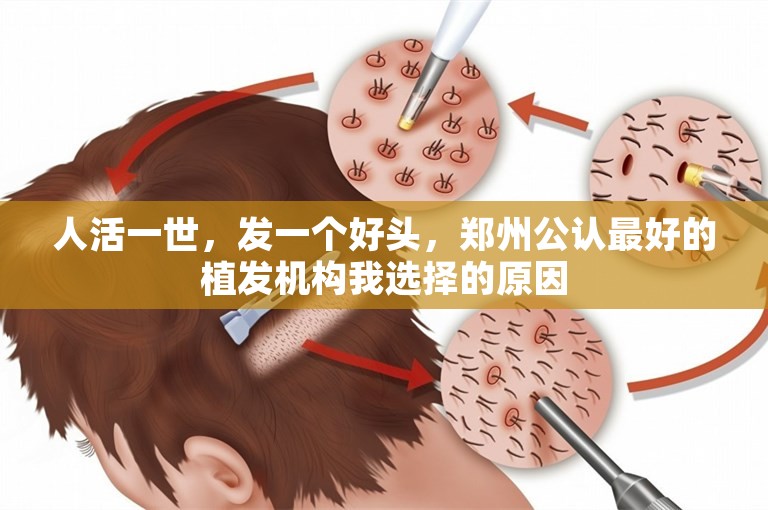 人活一世，发一个好头，郑州公认最好的植发机构我选择的原因