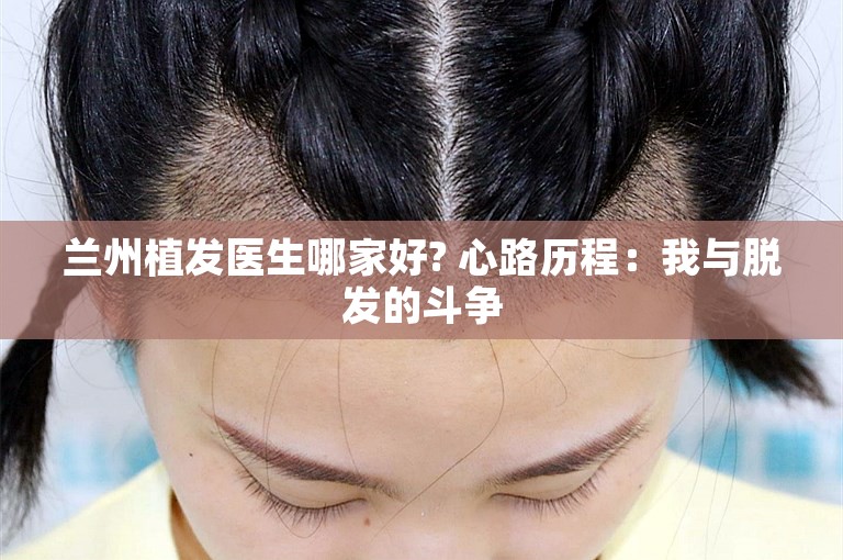 兰州植发医生哪家好? 心路历程：我与脱发的斗争