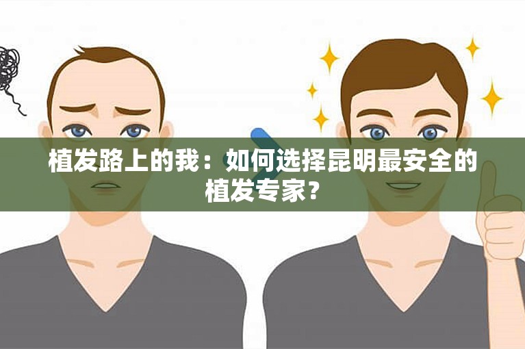 植发路上的我：如何选择昆明最安全的植发专家？