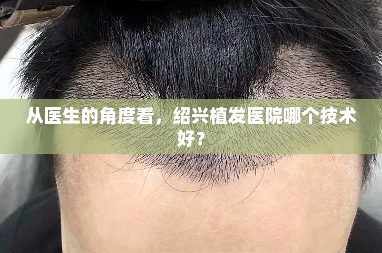 从医生的角度看，绍兴植发医院哪个技术好？