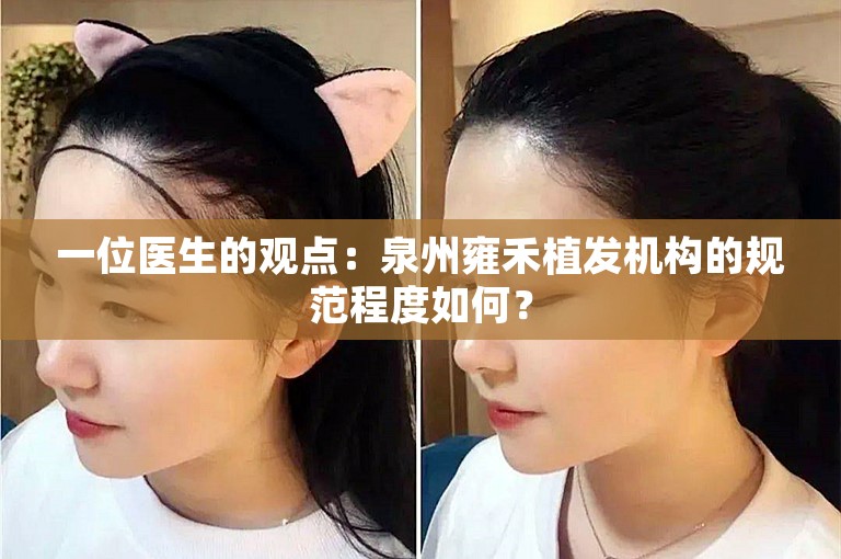 一位医生的观点：泉州雍禾植发机构的规范程度如何？