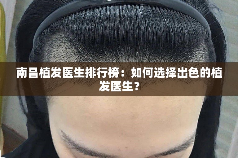 南昌植发医生排行榜：如何选择出色的植发医生？