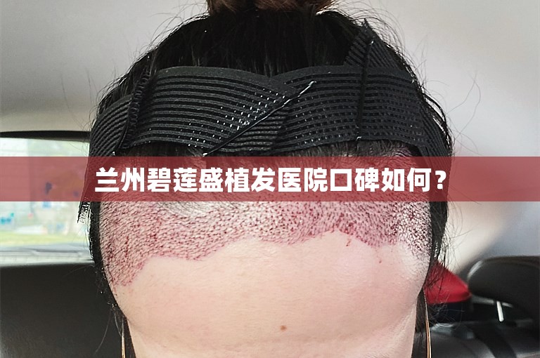 兰州碧莲盛植发医院口碑如何？