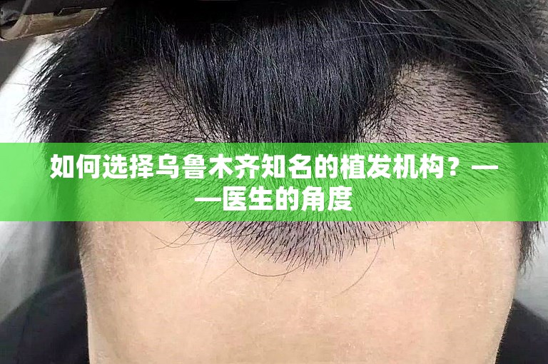 如何选择乌鲁木齐知名的植发机构？——医生的角度