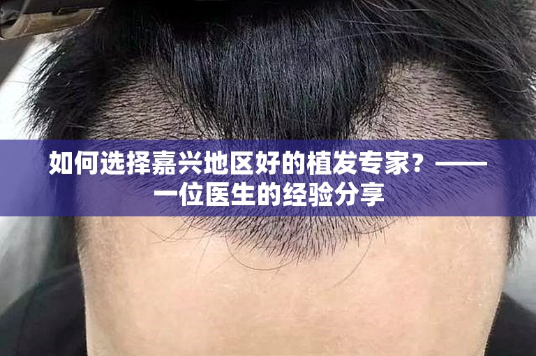 如何选择嘉兴地区好的植发专家？——一位医生的经验分享