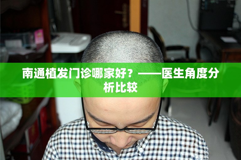 南通植发门诊哪家好？——医生角度分析比较