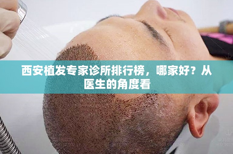 西安植发专家诊所排行榜，哪家好？从医生的角度看