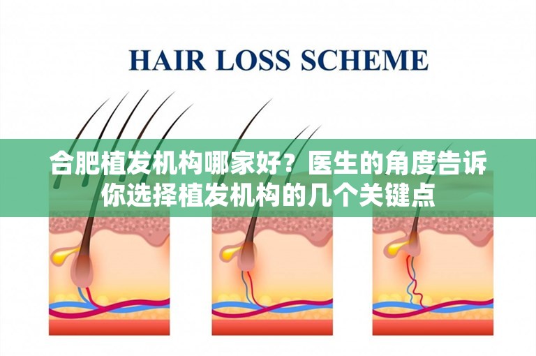合肥植发机构哪家好？医生的角度告诉你选择植发机构的几个关键点