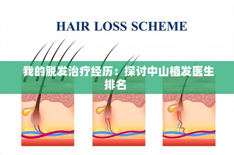  我的脱发治疗经历：探讨中山植发医生排名 