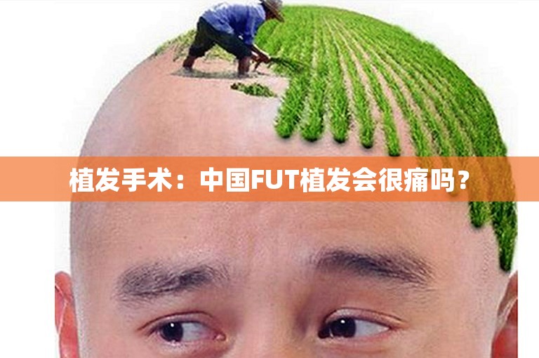 植发手术：中国FUT植发会很痛吗？