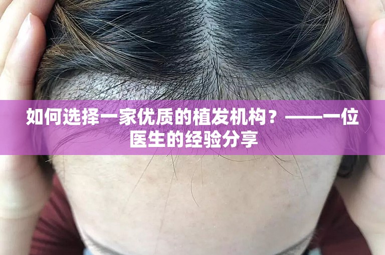 如何选择一家优质的植发机构？——一位医生的经验分享