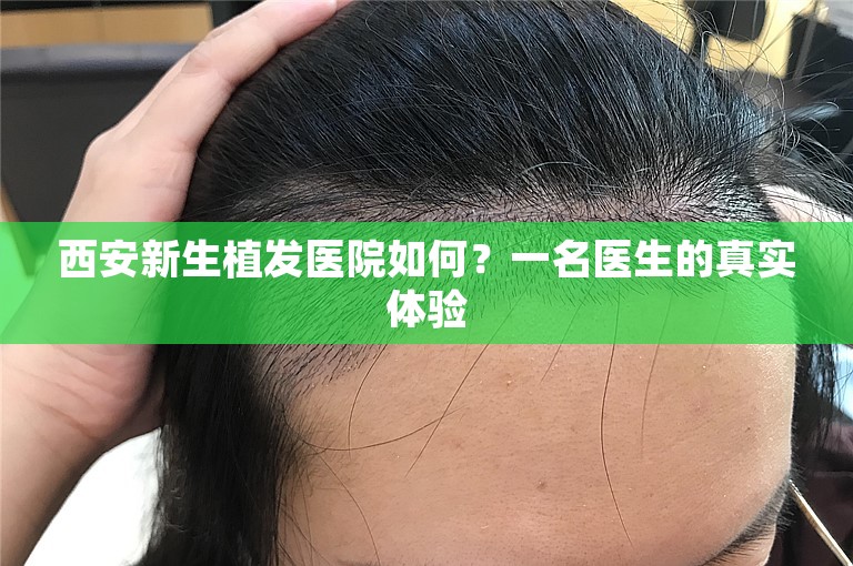 西安新生植发医院如何？一名医生的真实体验