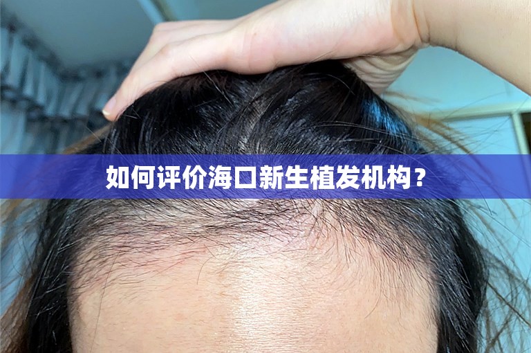 如何评价海口新生植发机构？