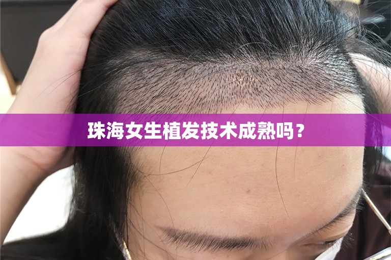 珠海女生植发技术成熟吗？