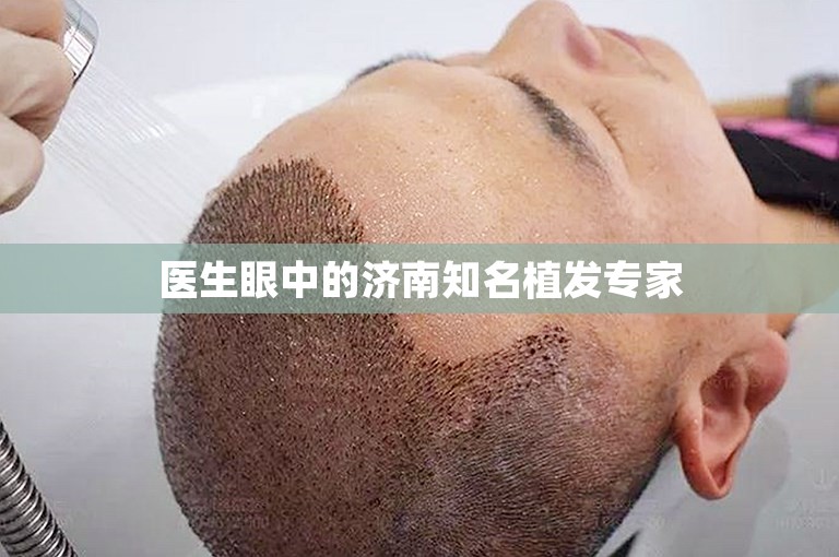 医生眼中的济南知名植发专家