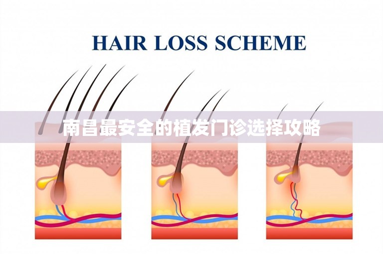 南昌最安全的植发门诊选择攻略