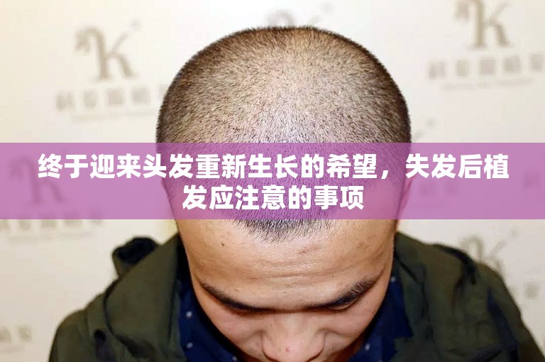 终于迎来头发重新生长的希望，失发后植发应注意的事项