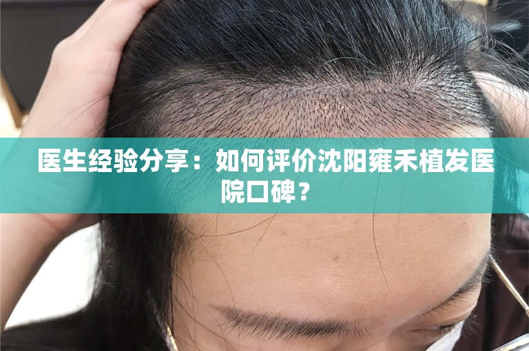 医生经验分享：如何评价沈阳雍禾植发医院口碑？